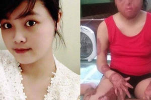 Hà Nội: Đã bắt được người chồng dùng xăng thiêu sống vợ Hà Nội: Đã bắt được người chồng dùng xăng thiêu sống vợ