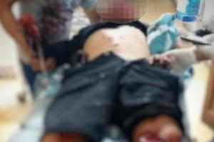 Nghi án nổ mìn tự chế, một người đàn ông nhập viện nguy kịch trong đêm giao thừa