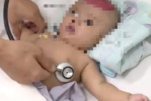 Điện thoại rơi trúng đầu, bé 3 tháng suýt tử vong