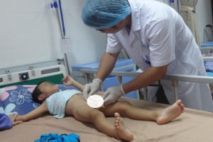 Kiểm tra dịch tễ toàn huyện Khoái Châu tìm nguyên nhân hơn 70 trẻ bị sùi mào gà