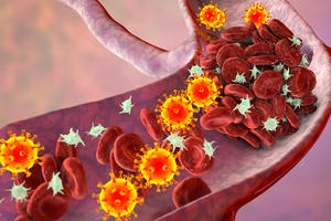 Cục máu đông - biến chứng nguy hiểm của hậu Covid-19