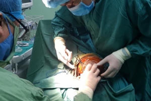 Cháu bé 5 tuổi bị chó nhà cắn toác nửa da đầu, lộ cả xương sọ