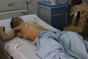 Bắt con mang bán không thành, đâm trọng thương công an