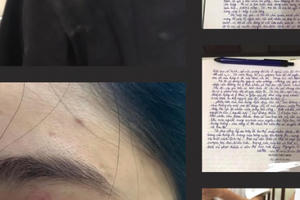 Xử phạt 2 nhân viên quán bánh mì Nguyên Sinh đánh khách hàng 13 triệu đồng