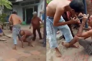 Nghịch tử đấm mẹ, chém cha gãy xương bả vai, tổn thương màng phổi