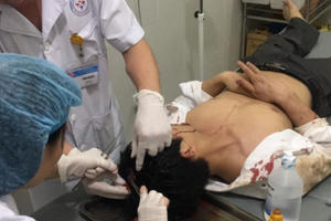 Vĩnh Phúc: Đi đòi nợ, nam thanh niên bị nhóm người lạ đánh nhập viện