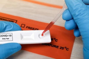 Bộ Y tế cấp phép 125 sản phẩm test xét nghiệm SASR-CoV-2