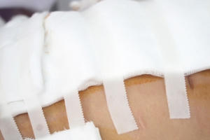 TP HCM: Lập tổ công tác xác minh vụ bệnh nhân thủng bụng sau khi hút mỡ