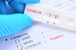 Cả nước có 55.879 ca nhiễm Covid-19, 8 tỉnh có trên hai nghìn người mắc