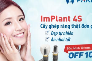 Nha khoa Paris ưu đãi GIẢM 10% với dịch vụ tái tạo răng bằng cấy ghép IMPLANT 4S như thật với công thức SLACTIVE