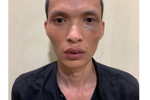 Bắt giữ đối tượng dùng kim tiêm đe doạ cướp điện thoại của bé gái