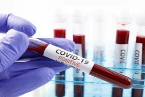 Cả nước có 1.344 ca mắc COVID-19 mới