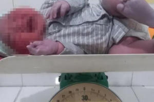 Bé trai chào đời nặng 6kg ở Hà Tĩnh