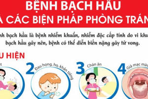 Thủ tướng Chính phủ yêu cầu tăng cường công tác phòng chống bệnh bạch hầu Thủ tướng Chính phủ yêu cầu tăng cường công tác phòng chống bệnh bạch hầu