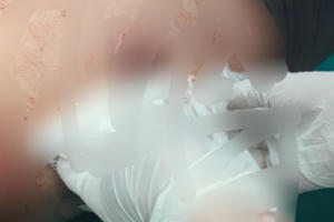 Gia Lai: Khẩn trương điều tra các đối tượng đâm đôi vợ chồng thương tích