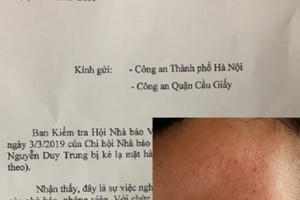 Hội Nhà báo Việt Nam đề nghị Công an điều tra, làm rõ vụ phóng viên bị hành hung