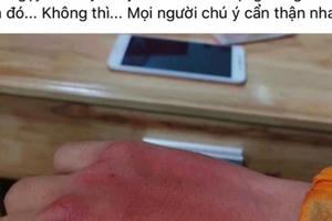 Xử lý thanh niên đăng tin sai sự thật về việc mình bị cướp "hụt"