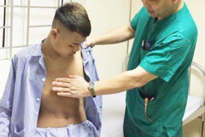 Hà Tĩnh: Lần đầu triển khai phẫu thuật nội soi điều trị bệnh lõm ngực bẩm sinh