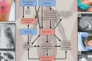 Kinh hãi vi khuẩn có trong đất, nước gây tử vong nhanh chóng