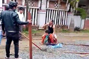 Chó dữ Pitbull tuột xích, cắn nát tay một phụ nữ đi đường