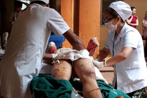 Krông Năng- Đắk Lắk: Phản ứng hóa chất phát nổ, một cháu bị cụt hai bàn tay