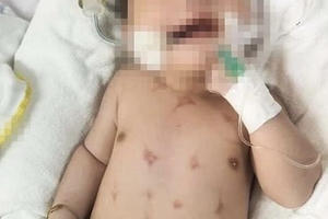 Nhờ thầy lang “lể đẹn” trẻ 16 ngày tuổi nhập viện