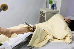 Thông tin mới nhất vụ tài xế Range Rover đâm gãy chân nữ sinh viên Đại học rồi bỏ chạy