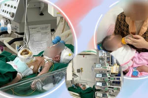 Cứu sống trẻ sơ sinh bị dị tật bẩm sinh Omphalocele hiếm gặp