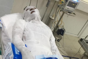 Hé lộ nguyên nhân người đàn ông bị tưới xăng, đốt cháy trên đường