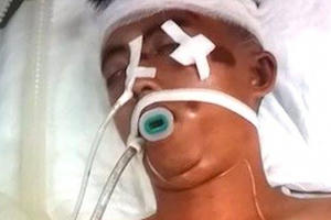 Tìm người thân khẩn cấp cho nam thanh niên nguy kịch sau tai nạn giao thông