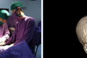 Cứu sống bệnh nhân 15 tuổi bị dao găm xuyên sọ