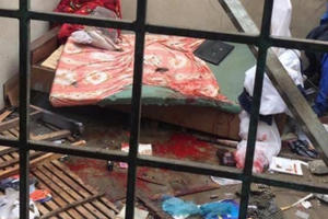 Nam thanh niên nát bàn tay sau tiếng nổ kinh hoàng