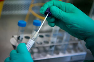 Mong chờ giá dịch vụ xét nghiệm Covid-19 đồng nhất