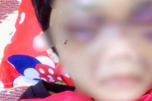 Hải Dương: Điều tra vụ bé gái 6 tuổi bị mẹ đẻ bạo hành đến mức phải nhập viện