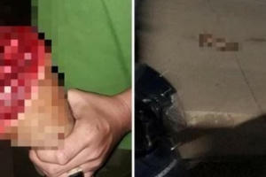 Tây Ninh: Đối tượng trong vụ hỗn chiến khiến thiếu niên 15 tuổi đứt lìa bàn chân ra đầu thú