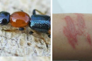 Cẩn thận kiến ba khoang khi mùa mưa đến Cẩn thận kiến ba khoang khi mùa mưa đến