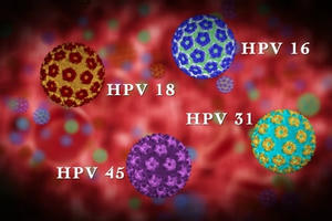 Hàng nghìn người Mỹ đứng ngồi không yên vì trót tiêm vắc xin HPV