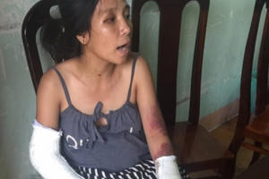 Công an điều tra vụ chồng đánh vợ mang bầu gãy tay, gãy chân