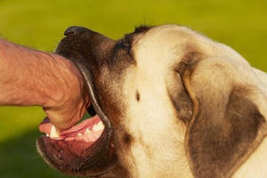 Chủ quan tiêm phòng dại sau khi bị chó cắn, một người đàn ông ở Lào Cai chết thảm