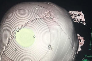 Cục trẻ em đề nghị điều tra vụ bé gái 3 tuổi nghi bị bạo lực ở huyện Thạch Thất