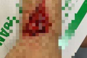 Hà Đông: Nhóm côn đồ manh động hành hung người giữa phố