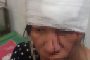 Mẹ quỳ xin, thai phụ câm điếc vẫn bị nam thanh niên đánh nhập viện