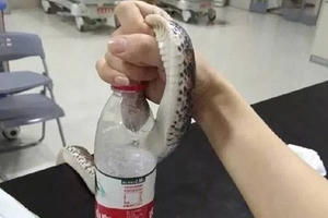 Bị cắn, cô gái túm cổ con rắn mang tới bệnh viện