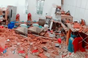 Nghi vấn chế pháo nổ, một nam sinh bị thương nặng phải nhập viên