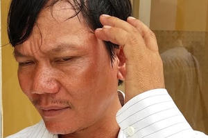 Sóc Trăng: Bị kiểm sát viên đánh được tăng tiền bồi thường