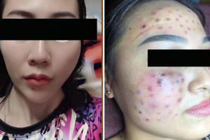 Vụ spa "cỏ" tại Hà Nội: Phòng y tế quận Cầu Giấy nói gì?