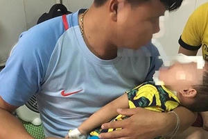 Bị chó Becgie tấn công, bé trai 2 tuổi tổn thương nặng vùng mặt