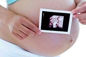 Có cần thiết phải siêu âm tim thai?