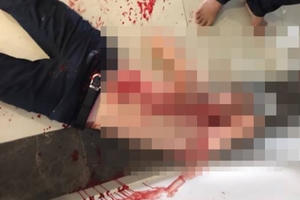 Đang ngồi uống cafe bỗng dưng bị chém đứt cơ cổ