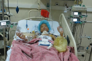 Thanh niên 17 tuổi bị ung thư phổi được ghép cùng lúc 2 lá phổi Thanh niên 17 tuổi bị ung thư phổi được ghép cùng lúc 2 lá phổi